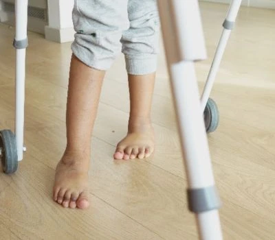 Razlika v dolžini noge: razumevanje neravnovesja, prepoznavanje škode in iskanje jasnosti s 3D sk...