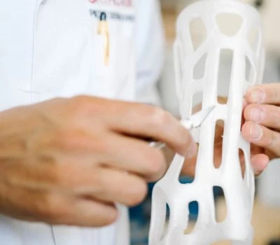 Izvoz formata datotek STL za 3D natisnjene ortotične vložke: Kako 3D skeniranje stopal pretvori b...