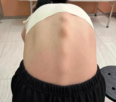 Revolucioniranje zdravja hrbtenice: Xianku 3D Body Scanner
